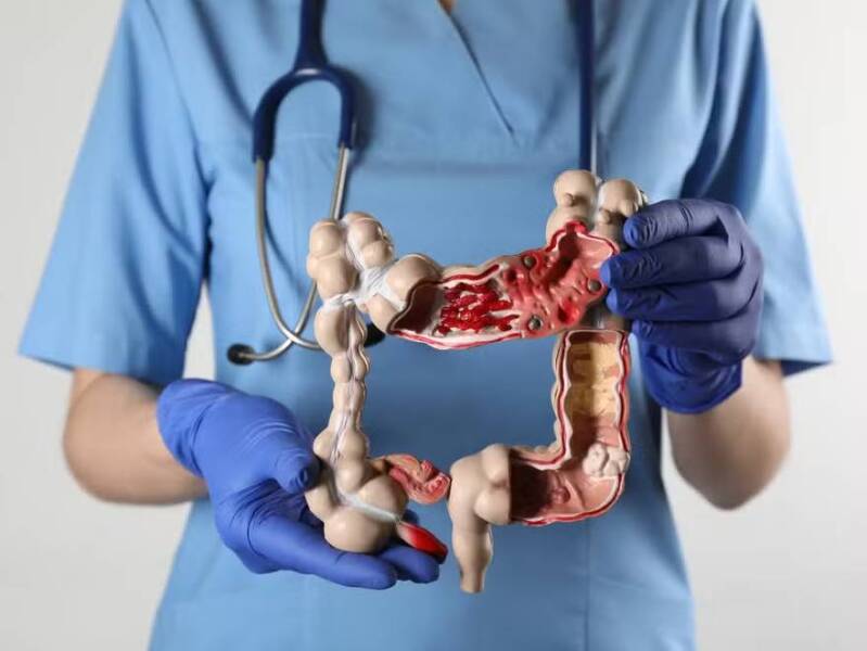 New study reveals food that can reduce colon cancer risk by 20%
